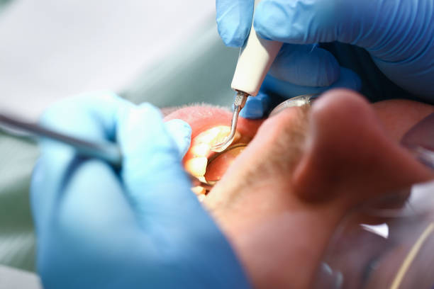 Best Emergency Treatment for Jaw Pain or Injury in Middletown, KY
