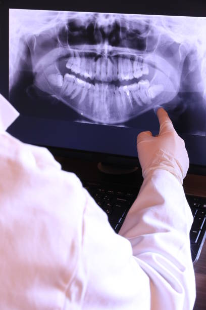 Best Dental Abscess Treatment in Middletown, KY