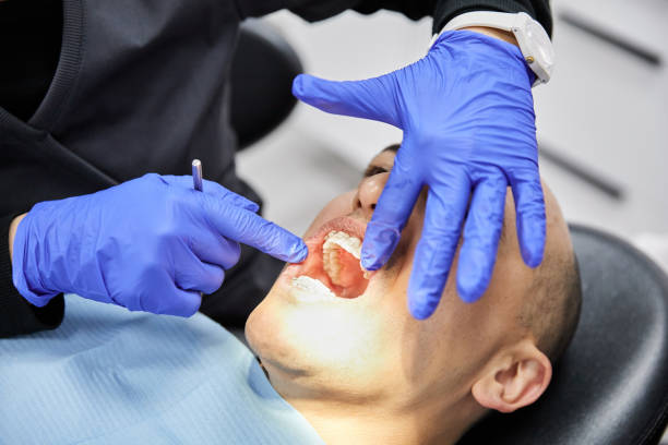Best Knocked-Out Tooth (Avulsed Tooth) Treatment in Middletown, KY